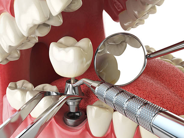Best Emergency Dental Care for Broken or Chipped Teeth in West Hamburg, PA